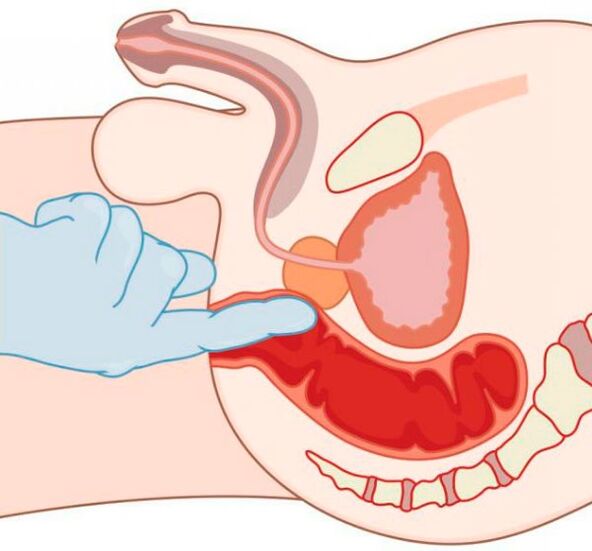 stimolazione del punto G in un uomo attraverso l'ano